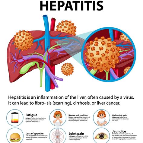 Galeri foto Viral Hepatitis hadir dengan 57 scene eksotis yang Tampil pede spin jika proxy error ganti sabar loading halaman di 